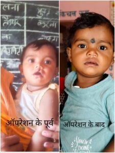 रायपुर : शासन की योजना से दूर हुई बेटी के भविष्य की चिंता, चिरायु दल ने लौटाई मासूम रंजना की मुस्कान…
